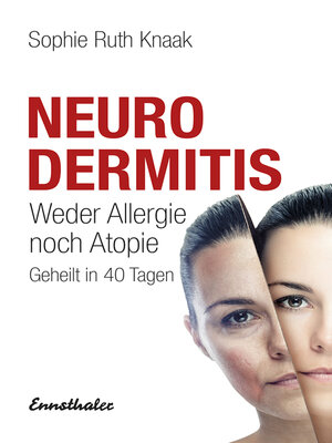 cover image of Neurodermitis